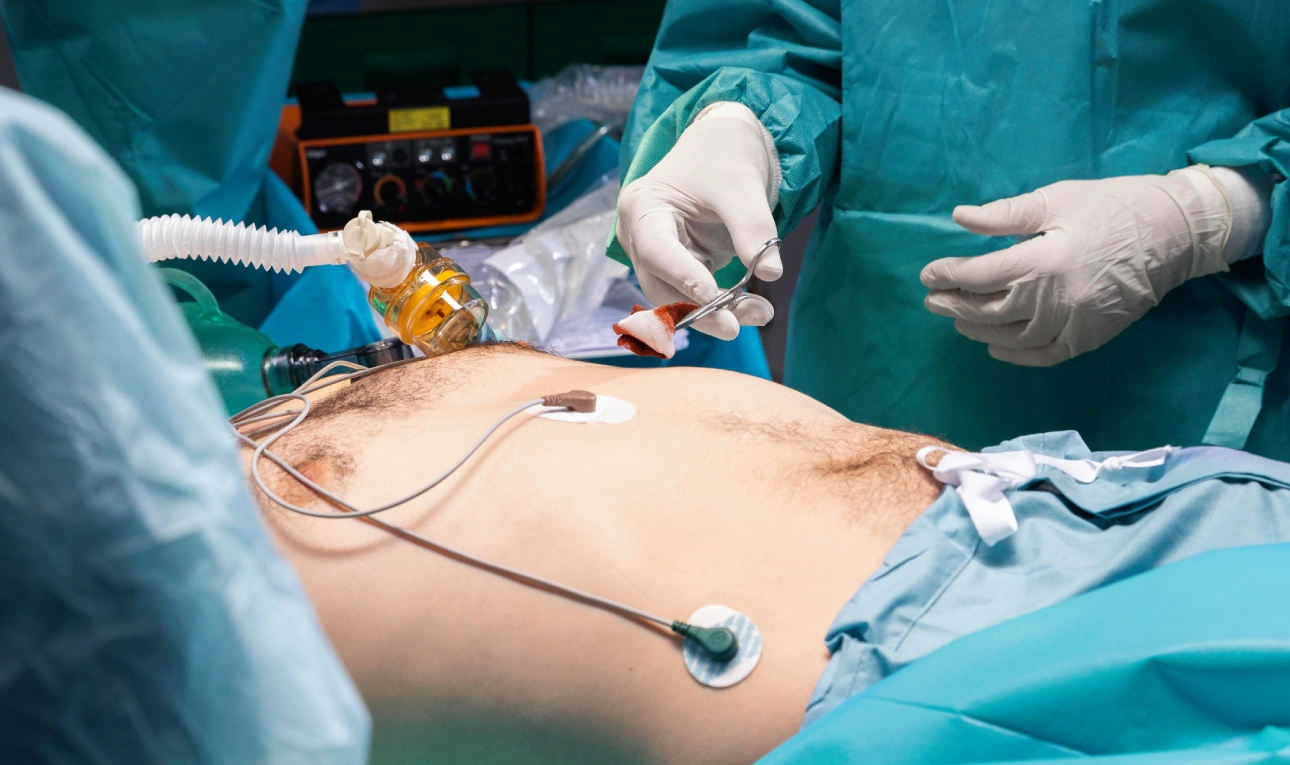 Liver Transplant