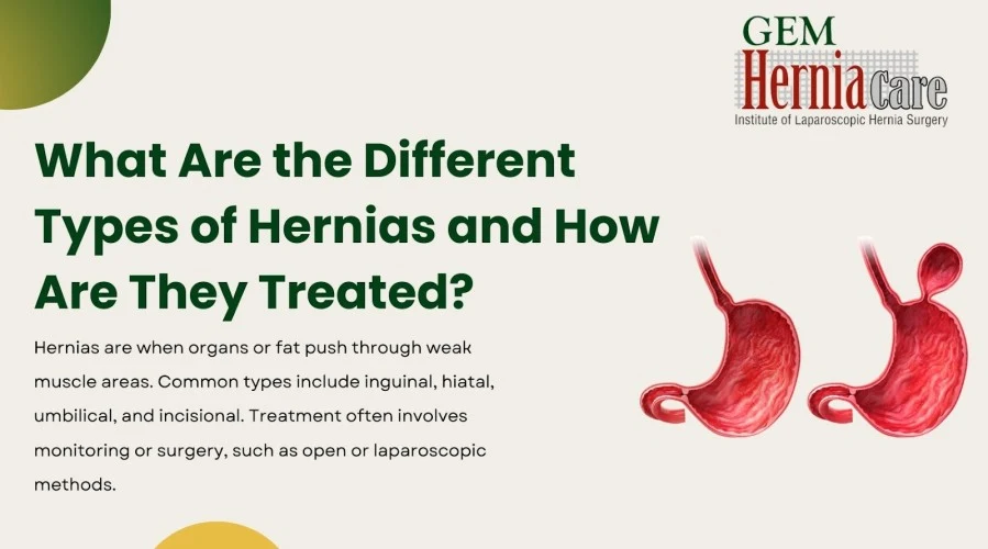 What Are the Different Types of Hernias and How Are They Treated