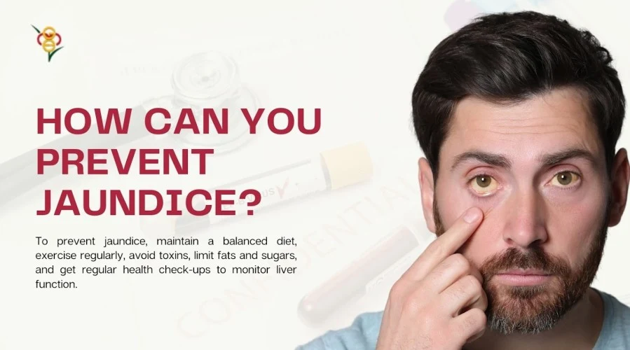 How can you prevent jaundice