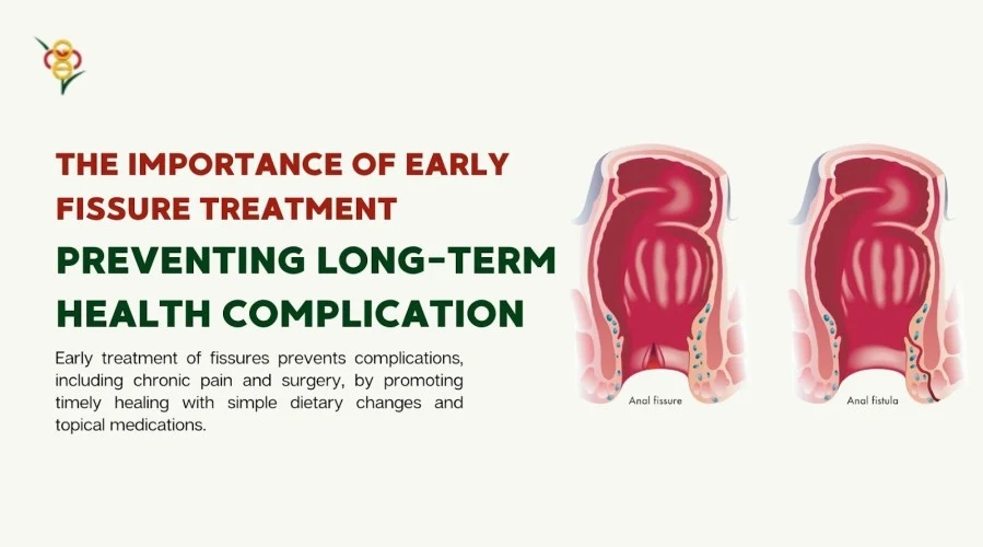 Why Early Treatment of Fissures Can Prevent Long-Term Complications