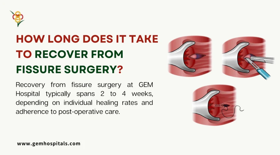 How Long Does It Take to Recover from Fissure Surgery