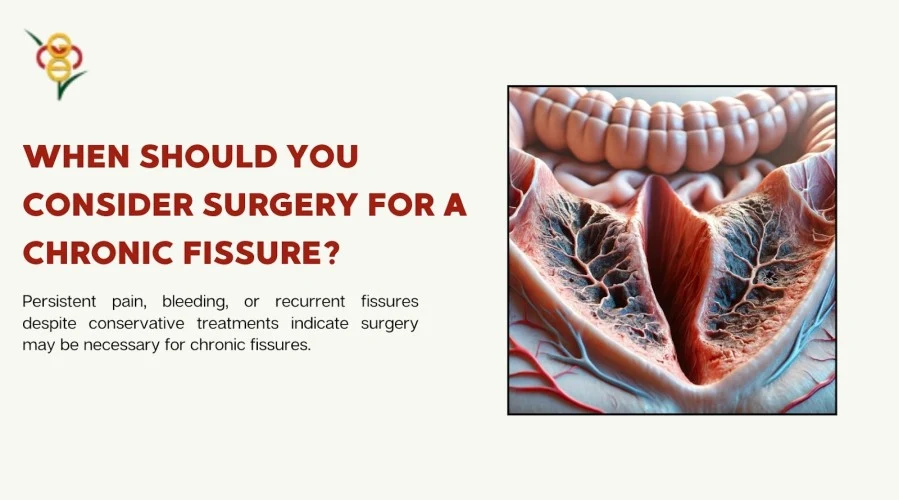 When Should You Consider Surgery for a Chronic Fissure
