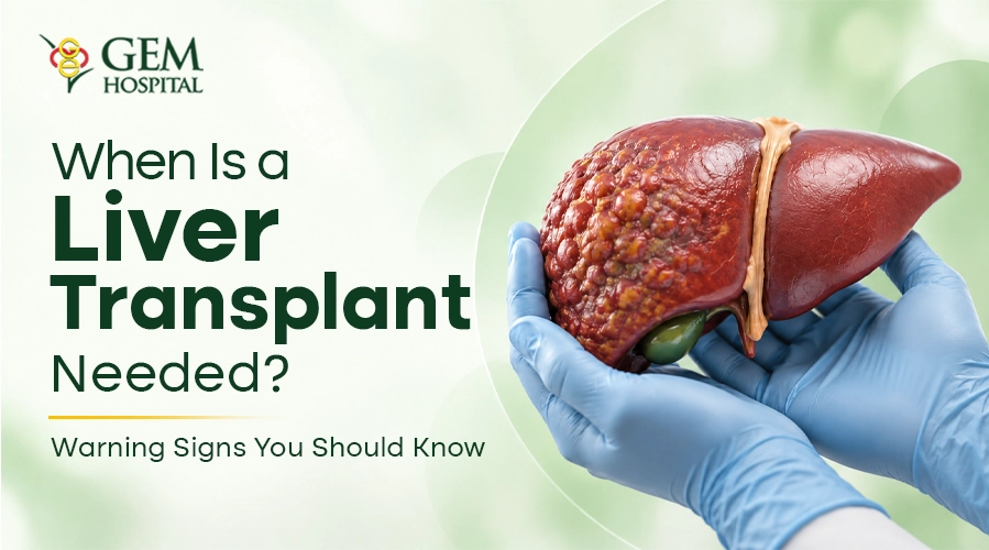 when-is-liver-transplant-needed-chennai