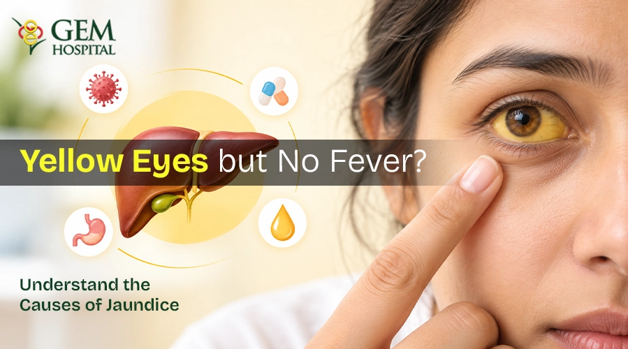 yellow-eyes-without-fever-causes-jaundice